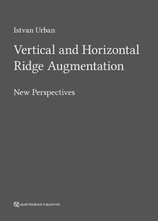عکس Vertical and Horizontal Ridge Augmentation