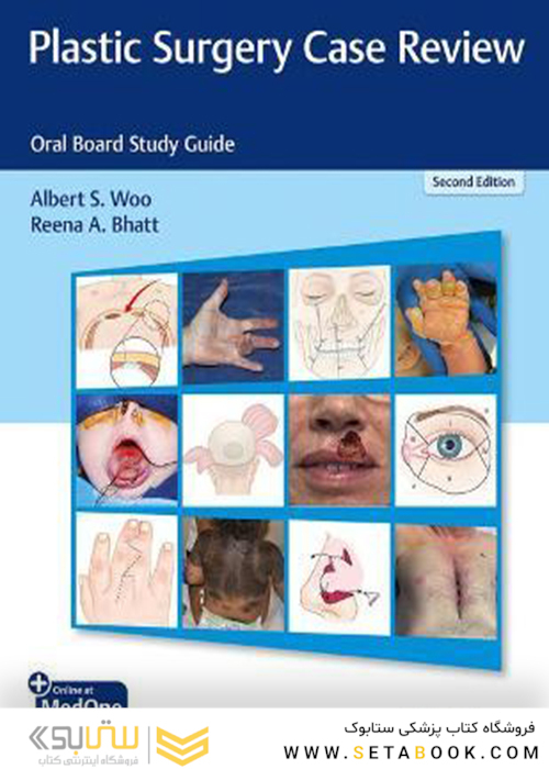Plastic Surgery Case Review: Oral Board Study Guide 2nd Edición