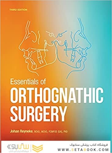 Essentials of Orthognathic Surgery 2022