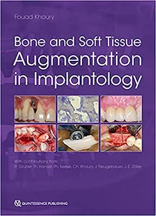 عکس Bone and Soft Tissue Augmentation in Implantology 2022