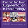 Bone and Soft Tissue Augmentation in Implantology 2022