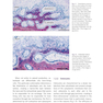 Bone and Soft Tissue Augmentation in Implantology 2022