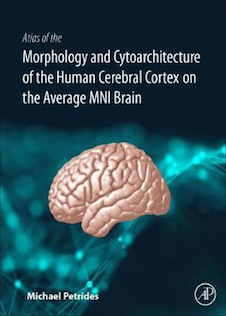 عکس Atlas of the Morphology of the Human Cerebral Cortex on the Average MNI Brain