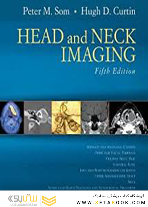 Head and Neck Imaging 5th Edition2011