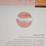 اصول و مبانی کاربردی در پروتز ثابت