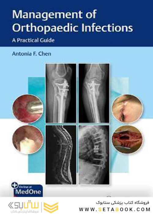 Management of Orthopaedic Infections: A Practical Guide 1st Edición
