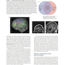 Neuroscience 6th Edition