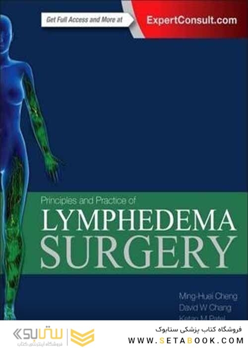 Principles and Practice of Lymphedema Surgery