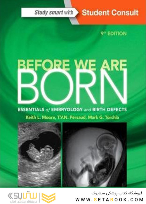Before We Are Born : Essentials of Embryology and Birth Defects