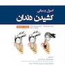 اصول و مبانی کشیدن دندان