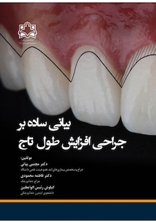 عکس بیانی ساده بر جراحی افزایش طول تاج