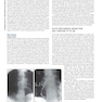 Braunwald’s Heart Disease, 2 Vol Set: A Textbook of Cardiovascular Medicine 2022