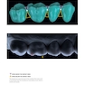 Dental Anatomy and Morphology