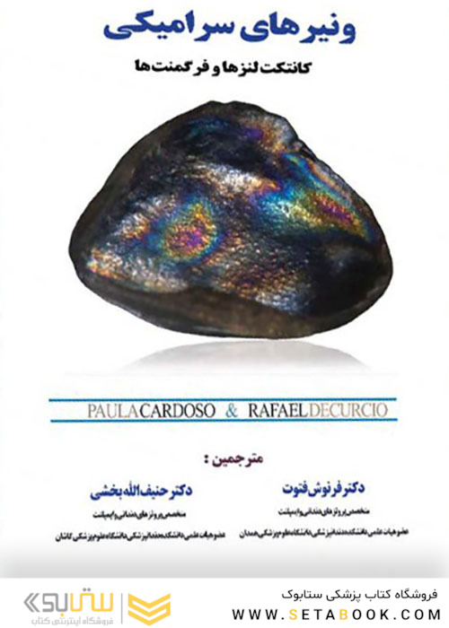ونیرهای سرامیکی کانتکت لنزها و فرگمنت ها