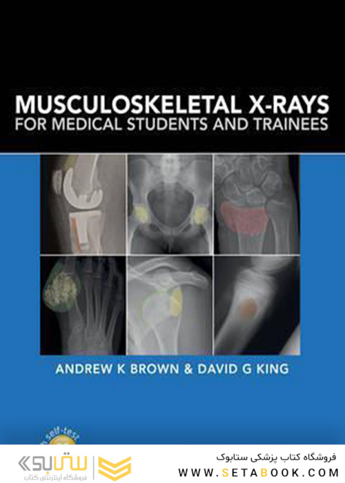 Musculoskeletal X-Rays for Medical Students and Trainees