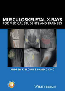 عکس Musculoskeletal X-Rays for Medical Students and Trainees