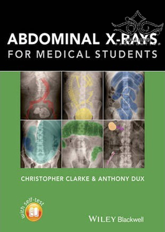 عکس Abdominal X-rays for Medical Student2015