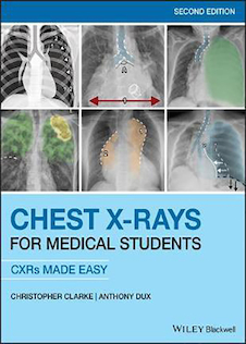 عکس Chest X-Rays for Medical Students: CXRs Made Easy 2nd Edition2020