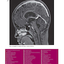 Weir - Abrahams’ Imaging Atlas of Human Anatomy