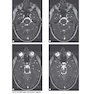 Weir - Abrahams’ Imaging Atlas of Human Anatomy