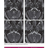Weir - Abrahams’ Imaging Atlas of Human Anatomy