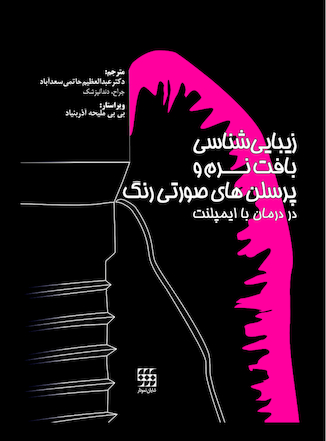 عکس زیبایی شناسی بافت نرم و پرسلن های صورتی رنگ در درمان با ایمپلنت