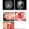 Surgical Atlas of Spinal Operations, 2nd Edition