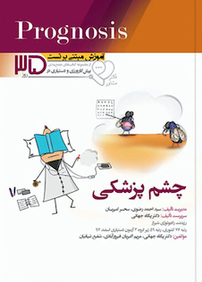 عکس آموزش مبتنی بر تست پروگنوز Prognosis چشم پزشکی