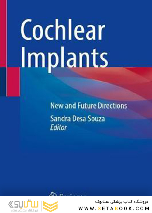 Cochlear Implants: New and Future Directions 1st ed. 2022 Edición