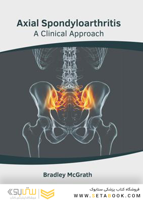 Axial Spondyloarthritis: A Clinical Approach