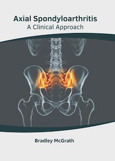 عکس Axial Spondyloarthritis: A Clinical Approach