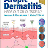 Atopic Dermatitis: Inside Out or Outside In