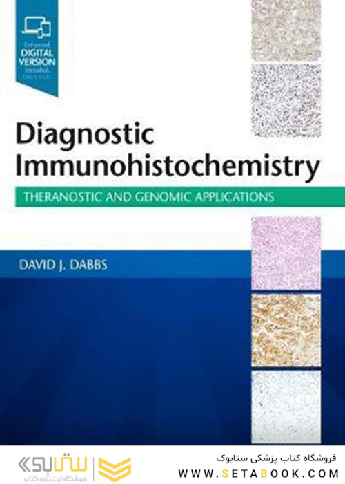 Diagnostic Immunohistochemistry : Theranostic and Genomic Applications