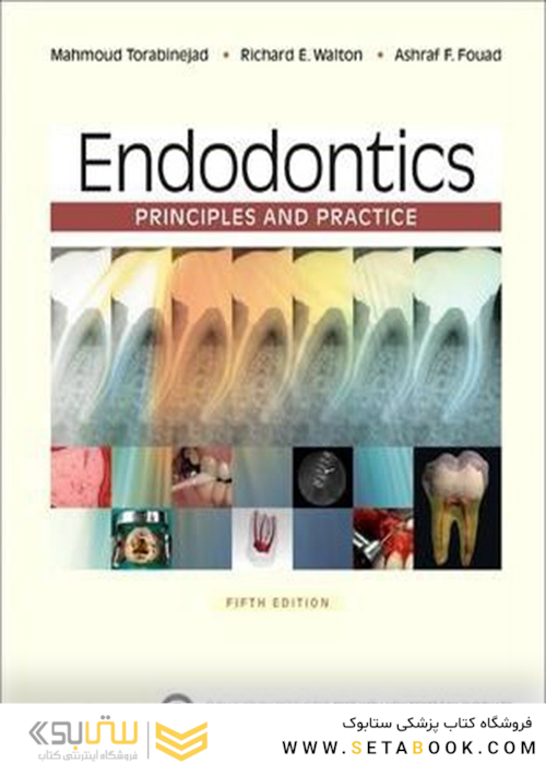 Endodontics : Principles and Practice