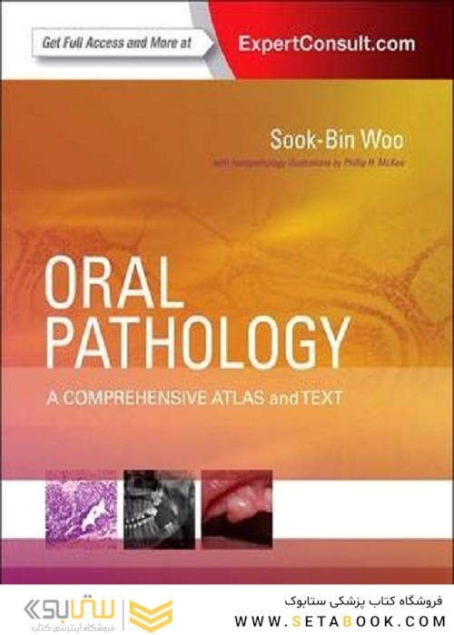 Oral Pathology : A Comprehensive Atlas and Text