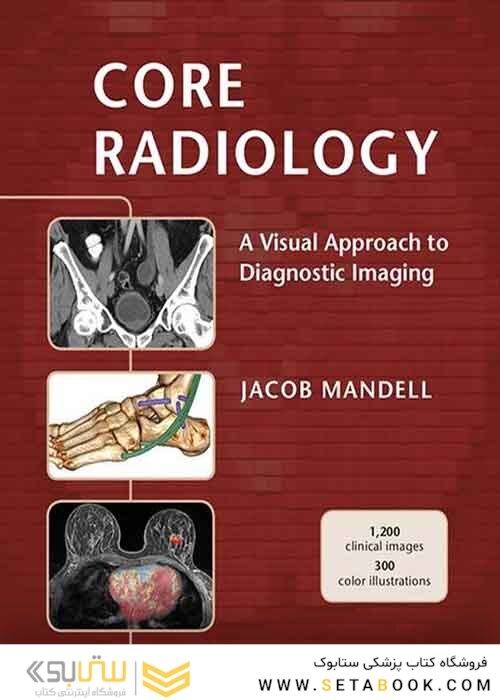 Core Radiology: A Visual Approach to Diagnostic Imaging 1st Edition 2013رادیولوژی هسته