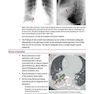 Core Radiology: A Visual Approach to Diagnostic Imaging 1st Edition 2013رادیولوژی هسته