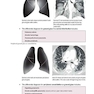 Core Radiology: A Visual Approach to Diagnostic Imaging 1st Edition 2013رادیولوژی هسته