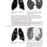 Core Radiology: A Visual Approach to Diagnostic Imaging 1st Edition 2013رادیولوژی هسته