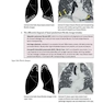 Core Radiology: A Visual Approach to Diagnostic Imaging 1st Edition 2013رادیولوژی هسته