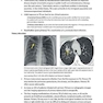 Core Radiology: A Visual Approach to Diagnostic Imaging 1st Edition 2013رادیولوژی هسته