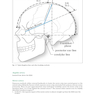 Handbook of Neurosurgery