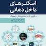 اسکنرهای داخل دهانی و کاربرد آن در دندانپزشکی دیجیتال