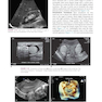 Textbook of Diagnostic Sonography: 2-Volume Set 8th Edition2017