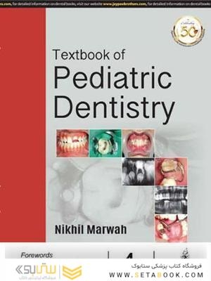 Textbook of Pediatric Dentistry