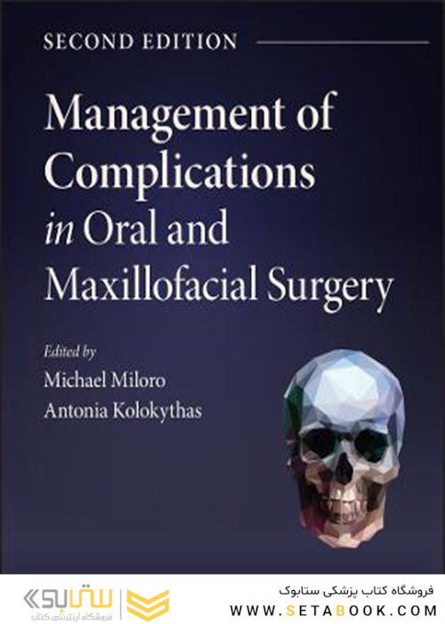 Management of Complications in Oral and Maxillofacial Surgery 2nd Edición