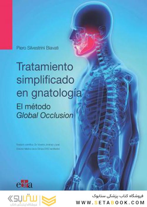 Oclusión global : tratamiento simplificado en gnatología