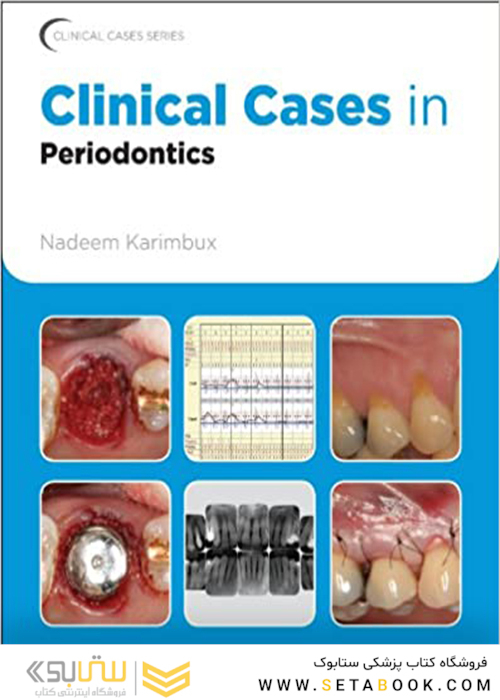 Clinical Cases in Periodontics (Clinical Cases (Dentistry) Book 42) 1st Edition موارد بالینی در پریودنتیکس