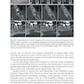 Shaping for Cleaning the Root Canals : A Clinical-Based Strategy 2022