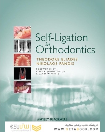 Self-Ligation in Orthodontics 1st Edición